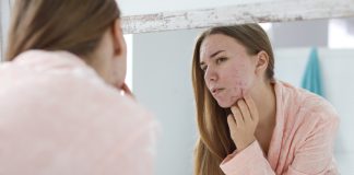 Acne Awareness Month