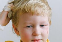 Head Lice, Pinworms, And The Less Desirable Side Of Motherhood